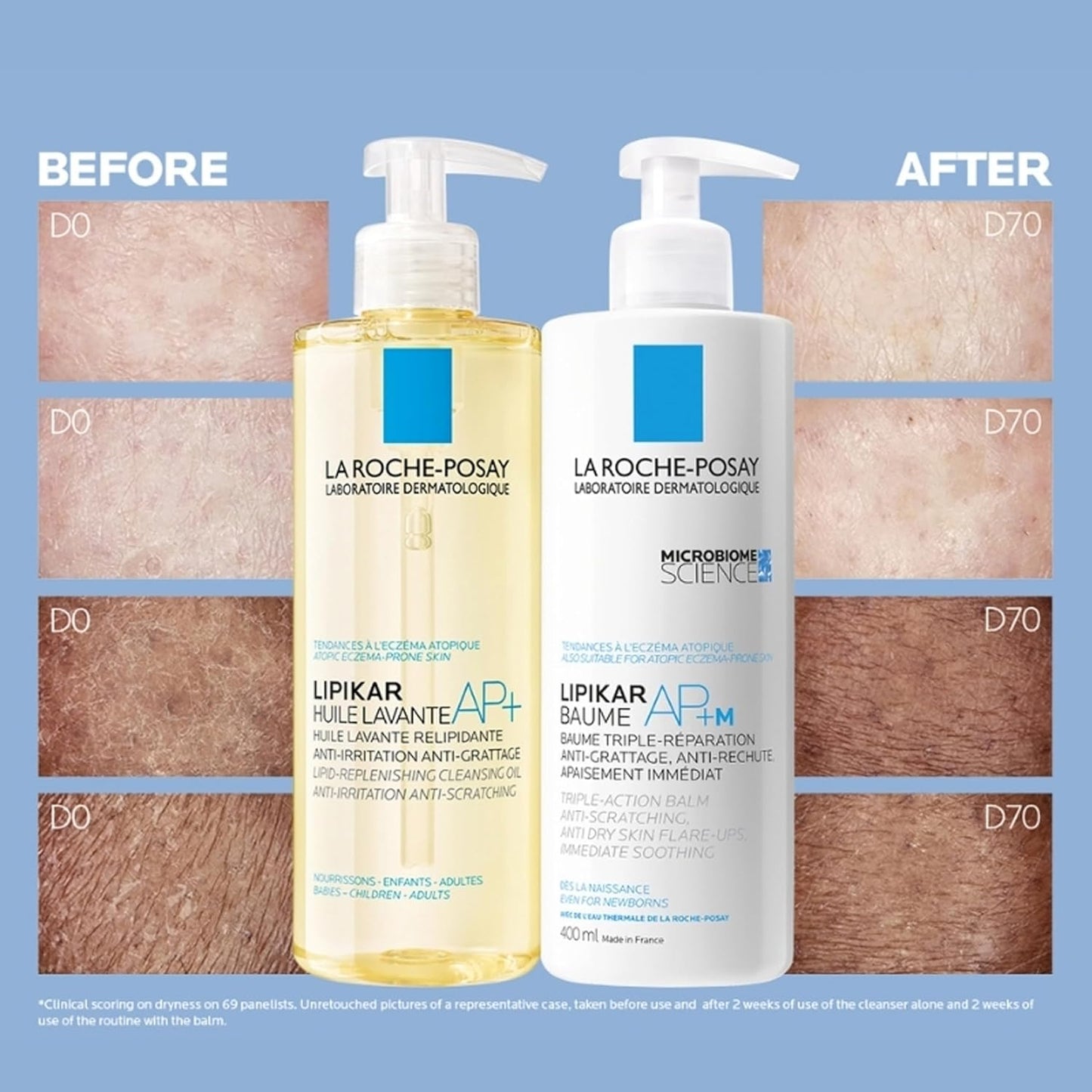 Face Cream & Body Lotion BUNDLE, Toleriane Dermallergo Creme & Lipikar Baume AP+M, Your Sensitive Skin Hydration Duo, Suitable for Sensitive, Dry to Very Dry Skin, Fragrance-Free