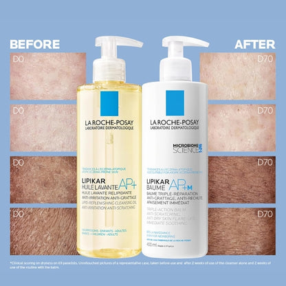 Face Cream & Body Lotion BUNDLE, Toleriane Dermallergo Creme & Lipikar Baume AP+M, Your Sensitive Skin Hydration Duo, Suitable for Sensitive, Dry to Very Dry Skin, Fragrance-Free